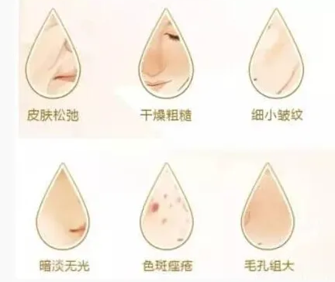 水光针美容:高性价比护肤项目全解析与实测体验分享