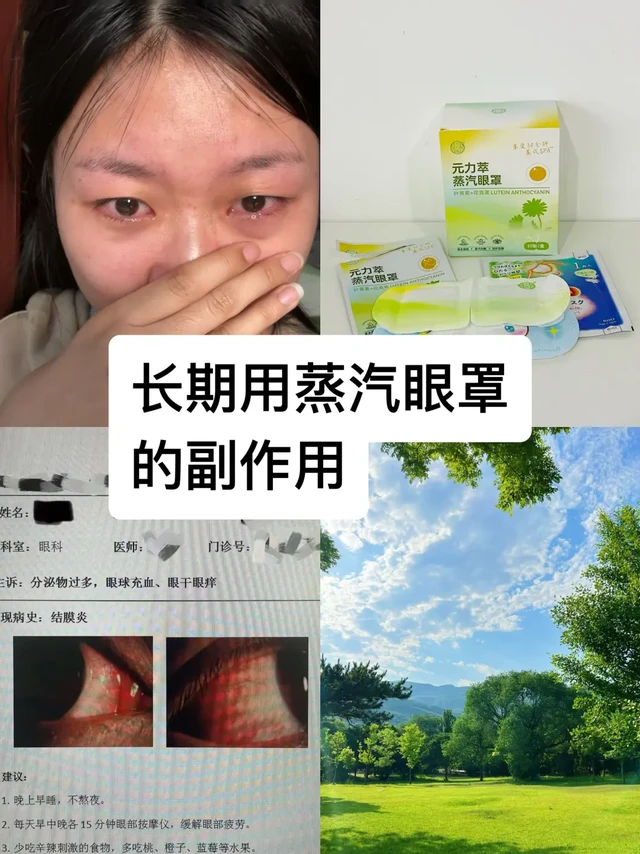 干眼症频繁用蒸汽眼罩的第一批受害者
