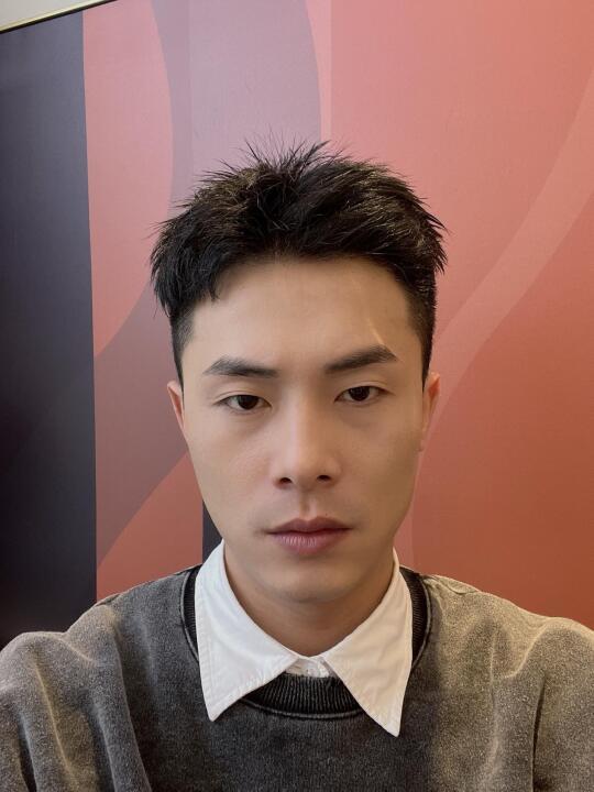 M型脱发、发际线后移是男性脱发的主要特征，图中的小帅哥被脱发折磨多年[失望R]，每次洗头都掉一大把，眼瞅着发际线越来越高。为了改变，来到雍禾做了植发际线改善[加油R]。
	
植发过程中，他有点小紧张，