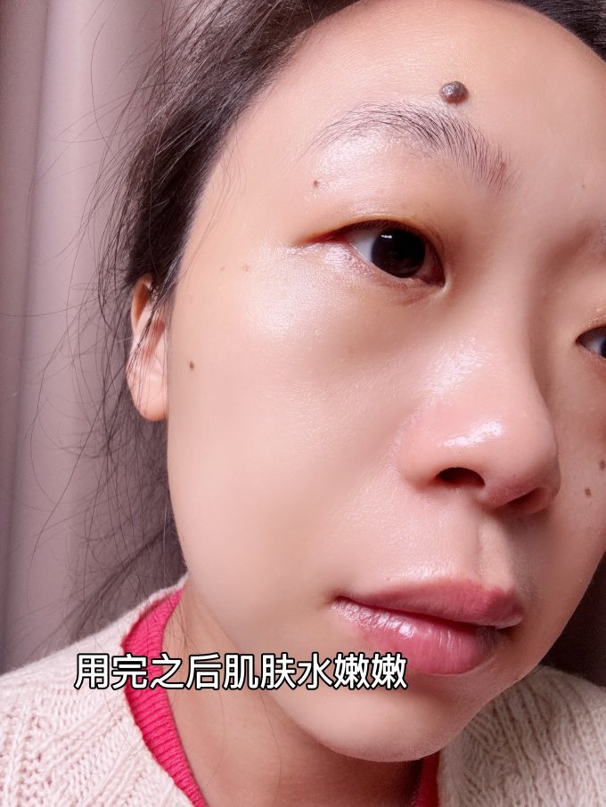 瑷尔博士护肤套装