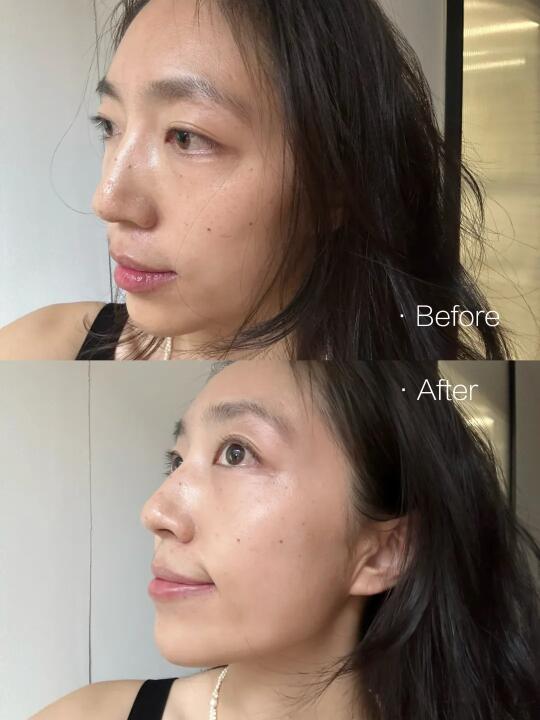 亢老届的敏肌天选A醇 你选对了吗❓