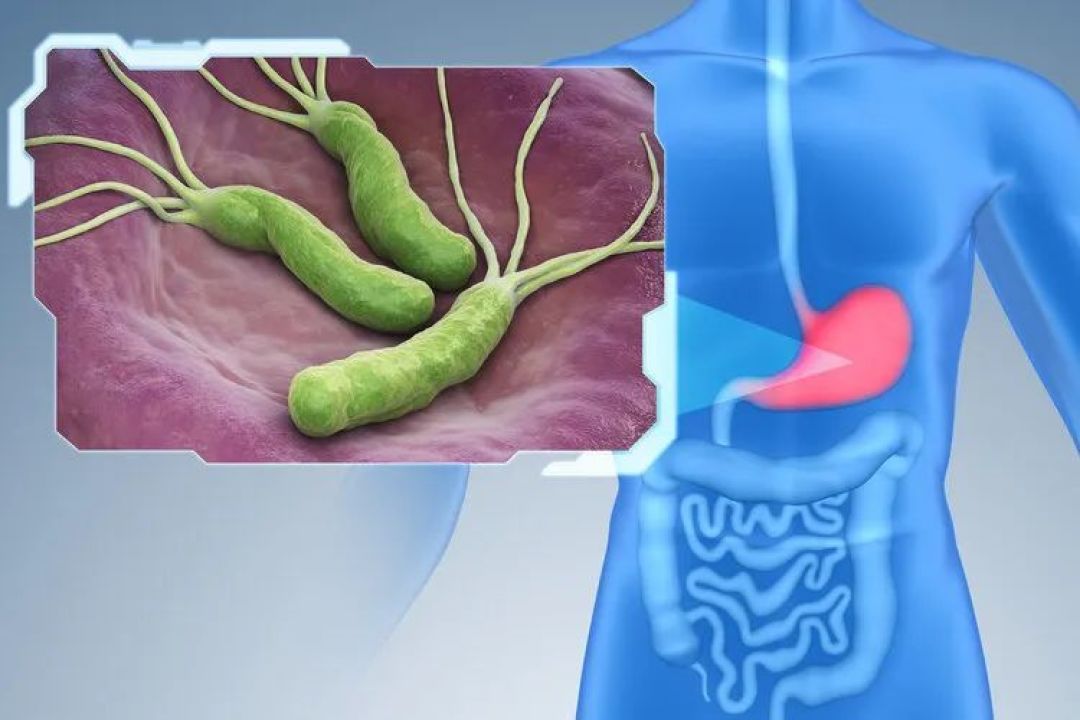 从炎症到癌症有多远?医生提醒:这4种炎症千万不要拖!