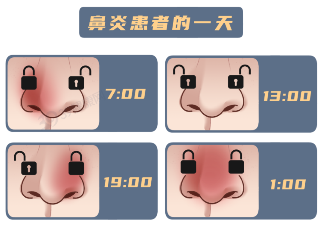 鼻炎反复发作太难受?别怕,4个方法帮你“对抗”鼻炎!