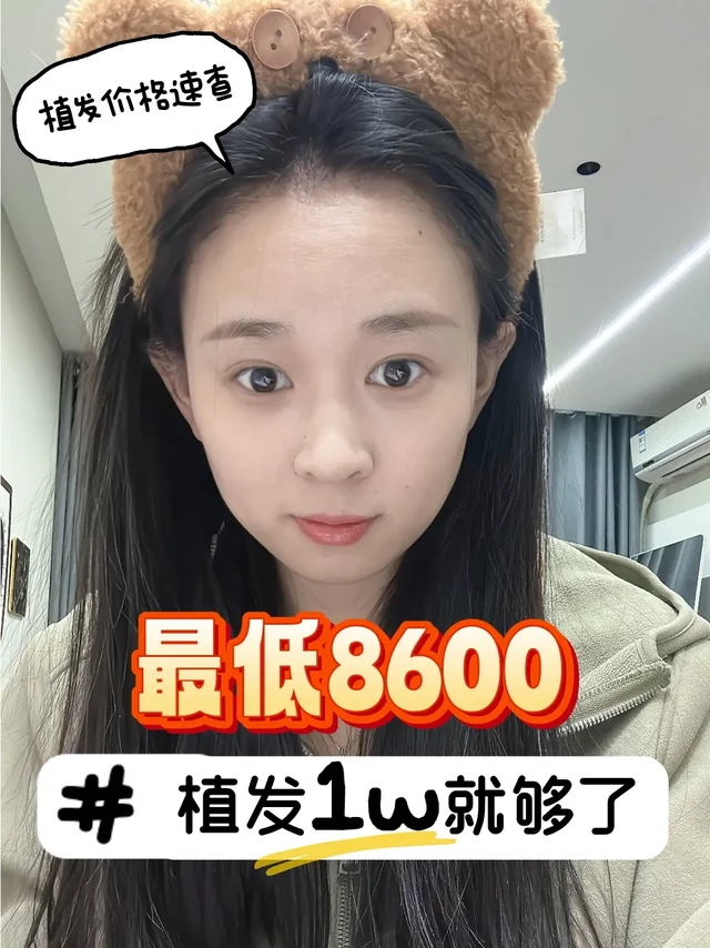 植发担心太贵💔看这篇就够了❗❗