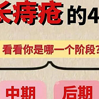 重度痔疮疼痛难忍！教你辨清4个痔疮等级！