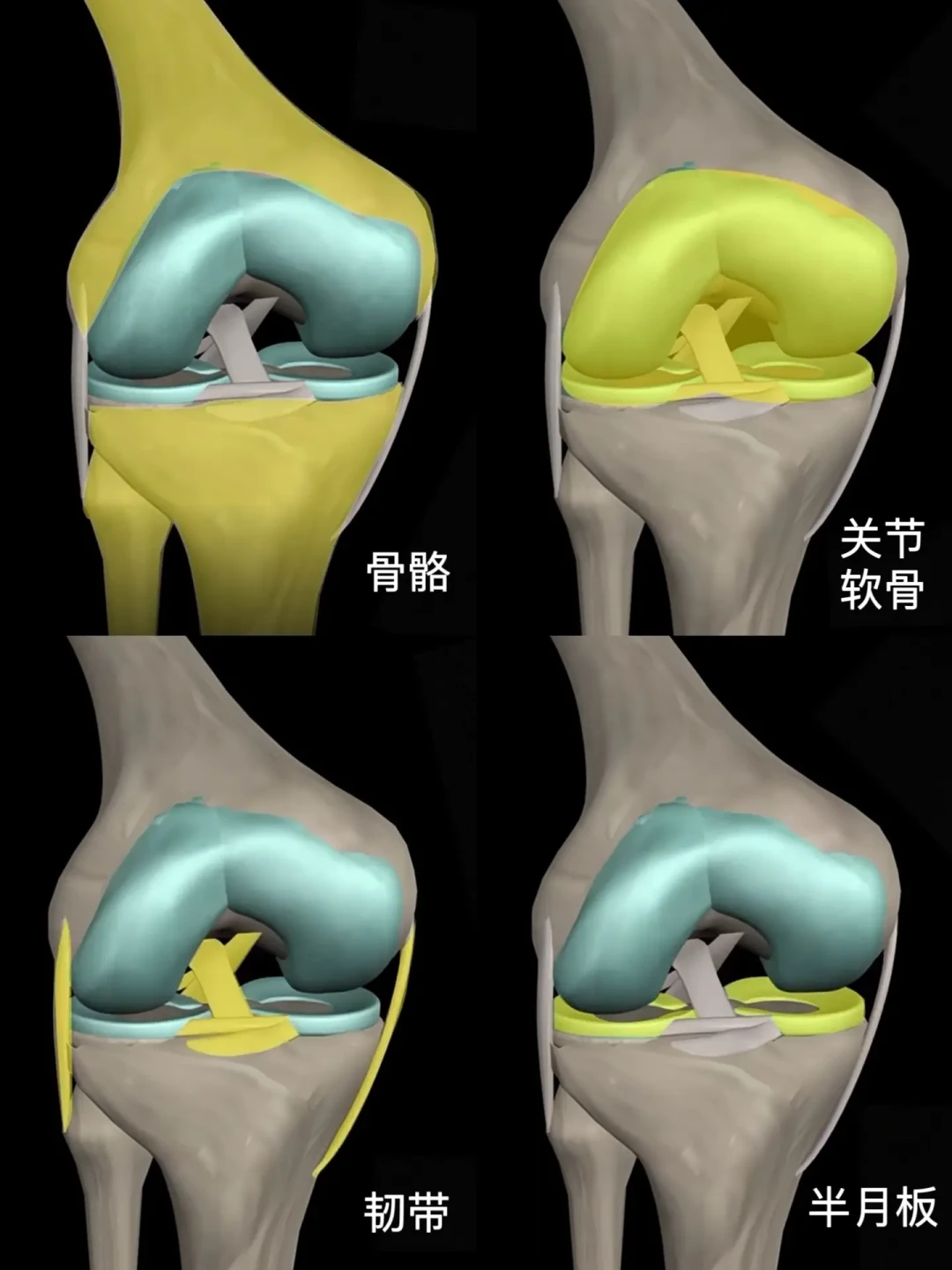 如何通过预防和早期治疗保护膝关节健康——全面解析膝关节结构和常见问题