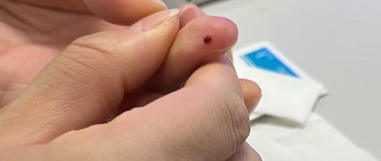 同事说吃多了，给她测下血糖
