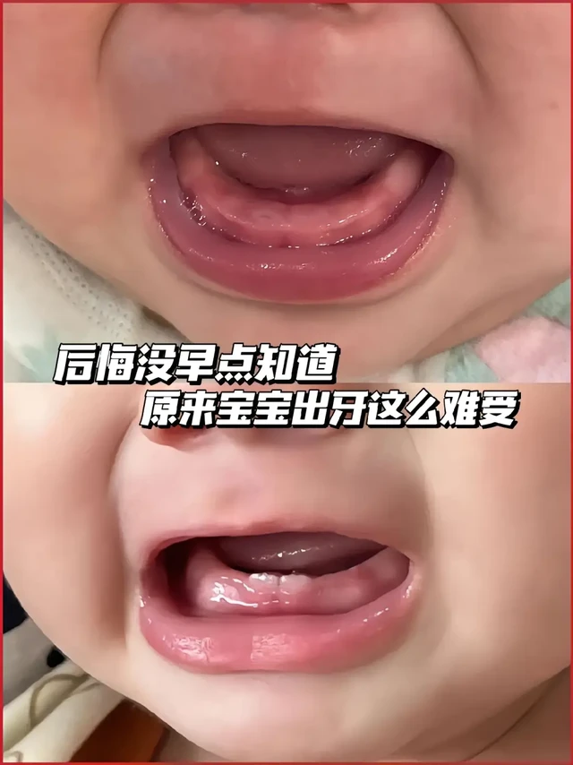 宝宝出牙的6大信号和出牙的12个阶段‼️
