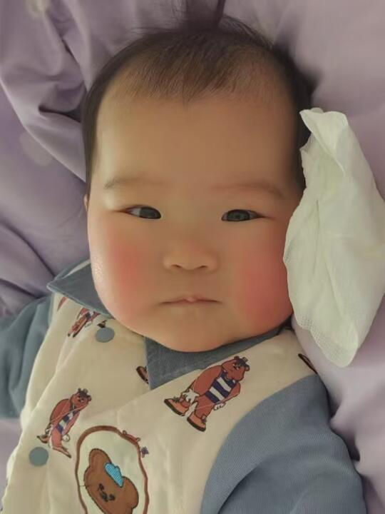 宝宝疹子看是不是AD，温度，衣服(过来人）