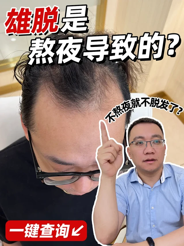 不熬夜脱发就会改善❓别陷入误区❗