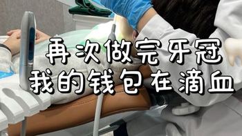 再次做完牙冠，我的钱包在滴血 
