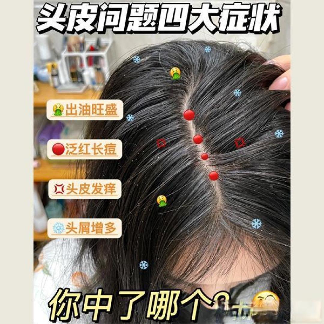 六款热门去屑洗发水大测评：找到最适合你的去屑利器