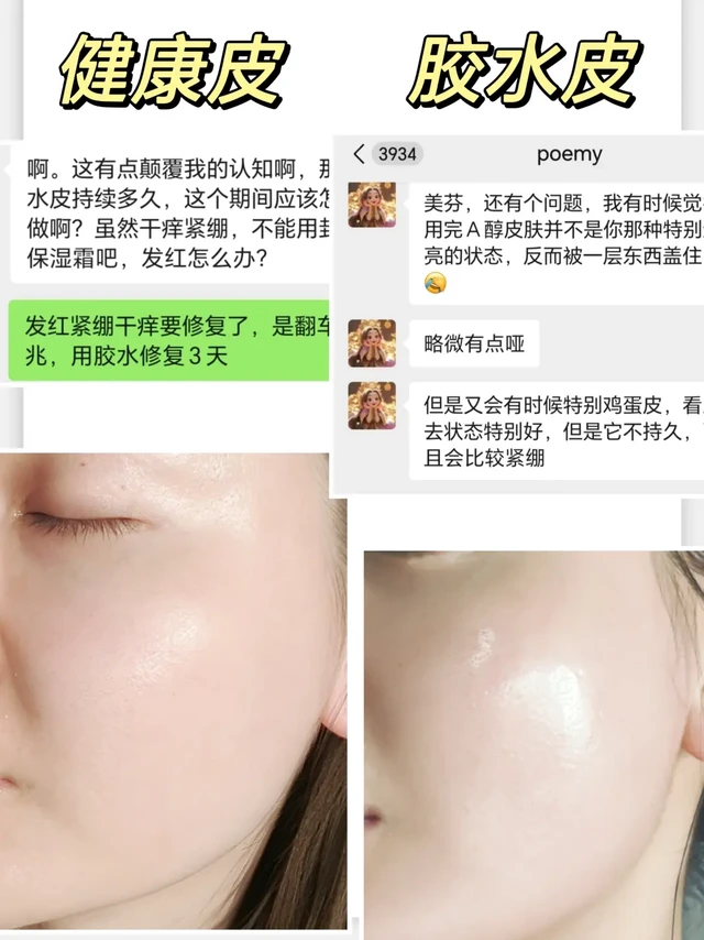 警惕A醇刷成水光肌！