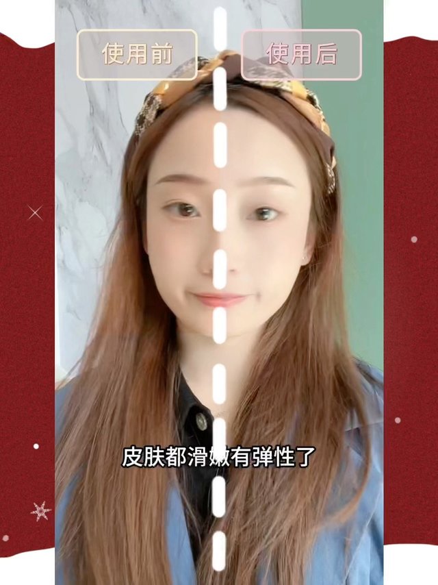 🍃芮思琳童颜水敏感肌的温柔疗愈师🍃 