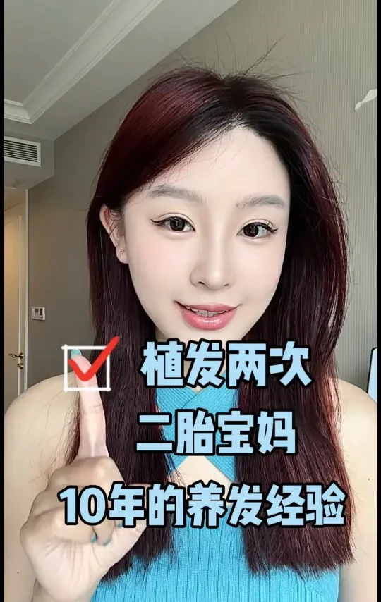 植发两次脱发十年的养发经验