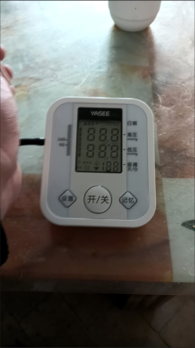血压计
