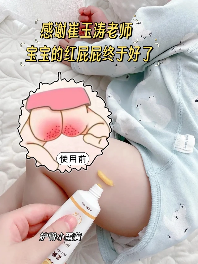 奶奶都夸好用的护臀膏!悦哺蛋黄油护臀膏，一款专为婴幼儿精心打造的保湿护臀霜。它是宝宝们的专属护臀好物，能够给予宝宝娇嫩的臀部肌肤悉心的呵护。其具有舒缓润肤的功效，能有效预防和缓解宝宝的红屁屁问题。温和