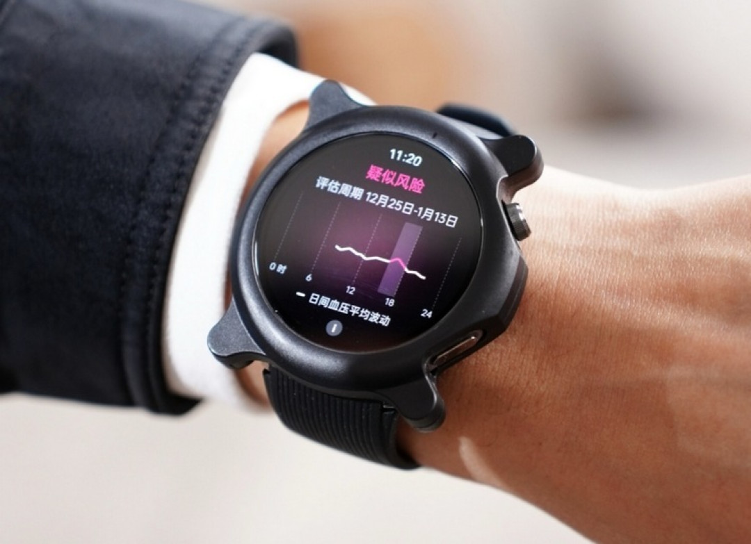 预热丨OPPO 将发布 Watch X2 智能手表,支持血压监测、独立通信
