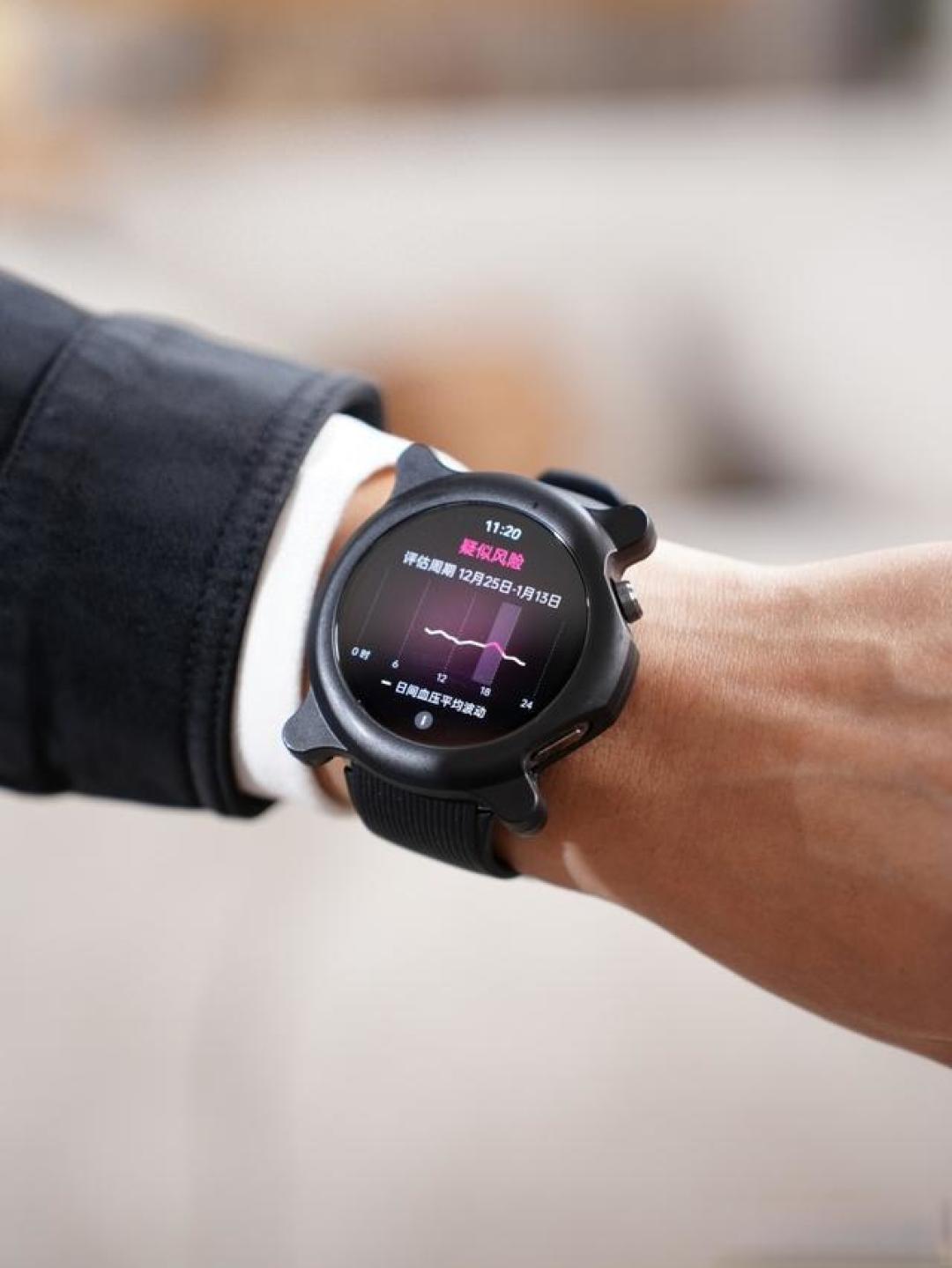 OPPO Watch X2：智能手表新标杆，血压监测与睡眠管理的突破性利器