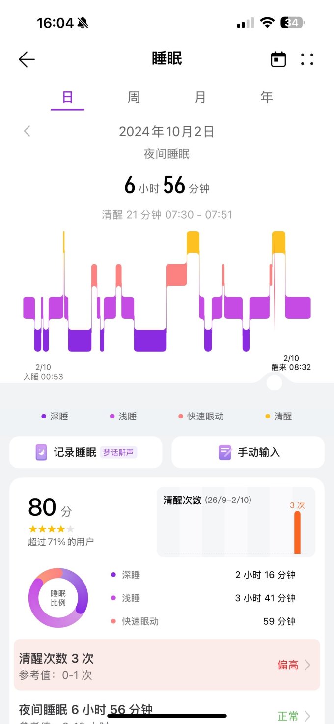苹果智能手表