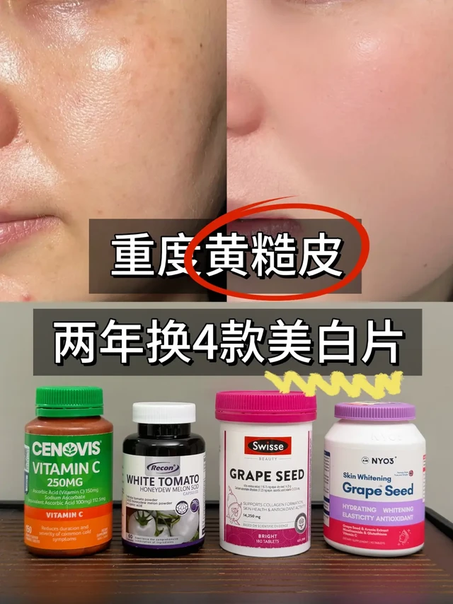 保姆级内调去黄挑选攻略！选不好不如不吃！