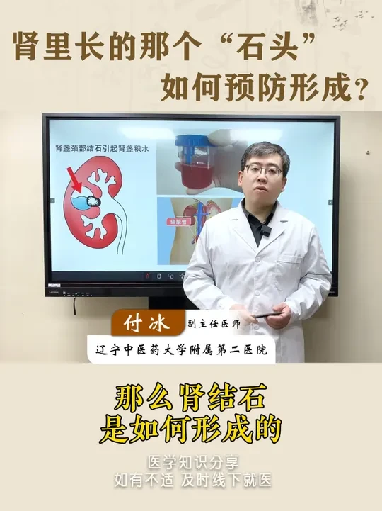 如何预防肾结石的形成？ #医学科普 #健康 #肾结石 #预防肾结石
