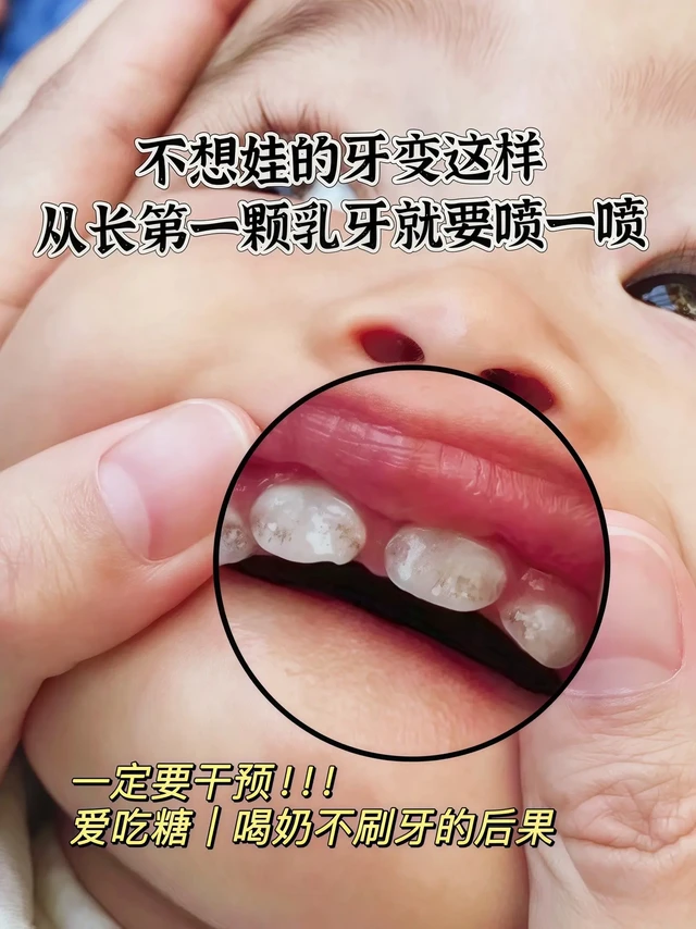 别再让宝宝口腔问题愁坏你！兔头妈妈幼儿童护齿喷雾来救场🥰✨

家有萌娃的宝妈们👩‍🍼，看过来啦！新年的钟声即将敲响，宝宝的口腔护理可不能掉链子！新年期间，宝宝零食、糖果🍬吃个不停，小嘴巴里很容易滋生细