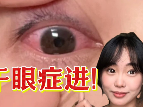 重生之护眼大作战！