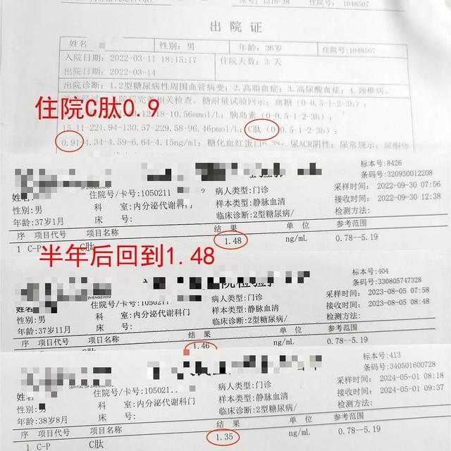 二型糖尿病3年，保住胰岛基础功能，看我是怎么做到的？