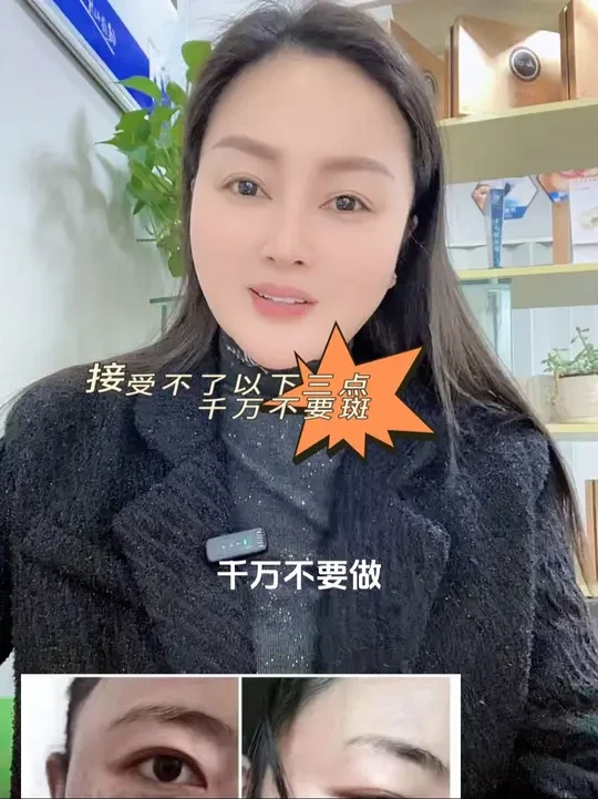 做斑接受不了以下三点千万不要做斑！#问题性皮肤管理 #美白淡斑提亮肤色 #好皮肤养出来