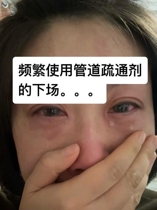 频繁使用管道疏通剂的下场。。。
