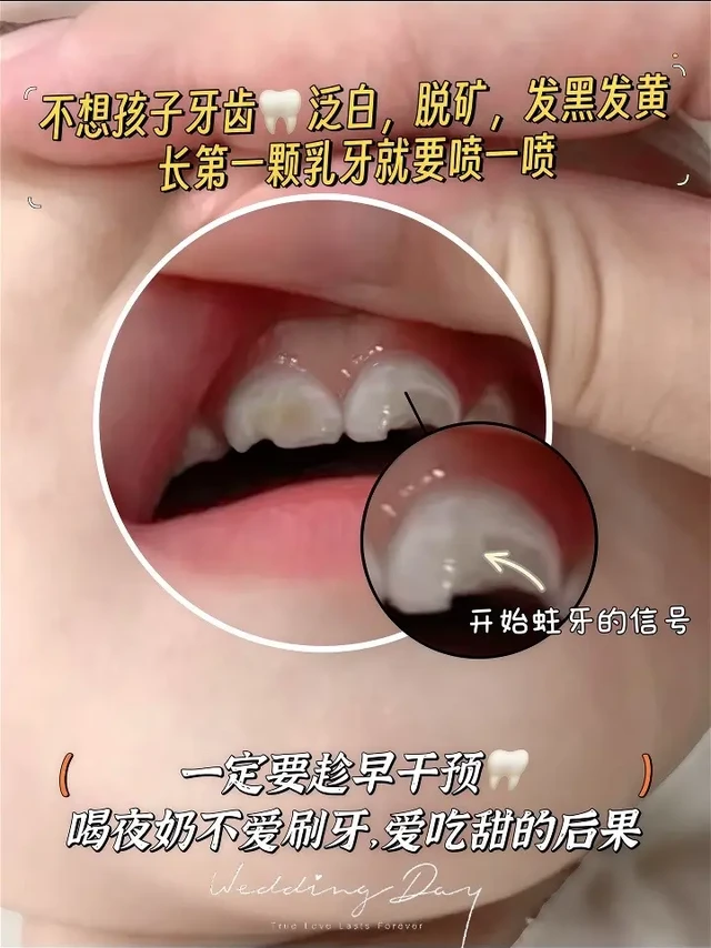 今天必须给你们安利兔头妈妈这款护齿喷雾。麻麻们～你们真的不要像我一样哈，等到宝宝牙齿出现问题了，才开始重视他的口腔护理～

小宝宝呢，只要长出一颗牙齿就应该刷牙。那如果
宝宝不配合的话呢，你就可以给他