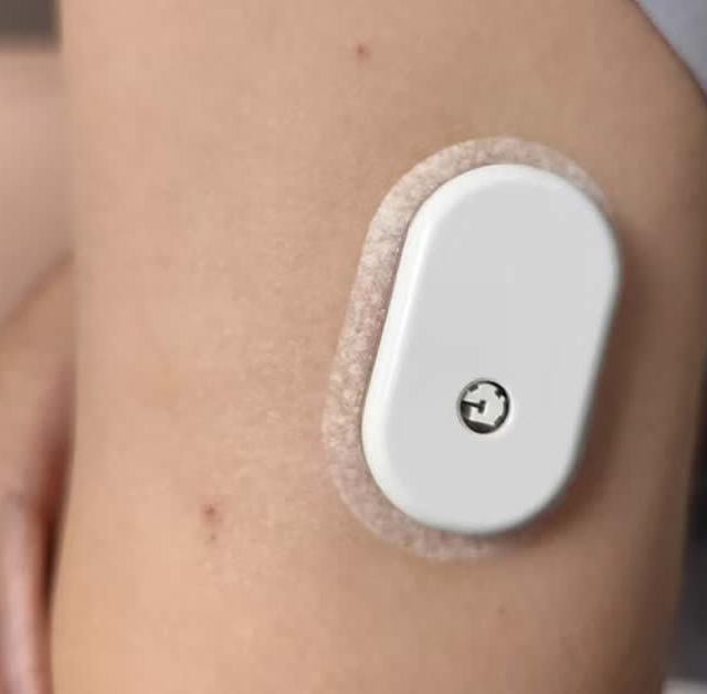 噩梦降临：孩子确诊 1 型糖尿病-糖宝宝家长的硅基动态使用分享