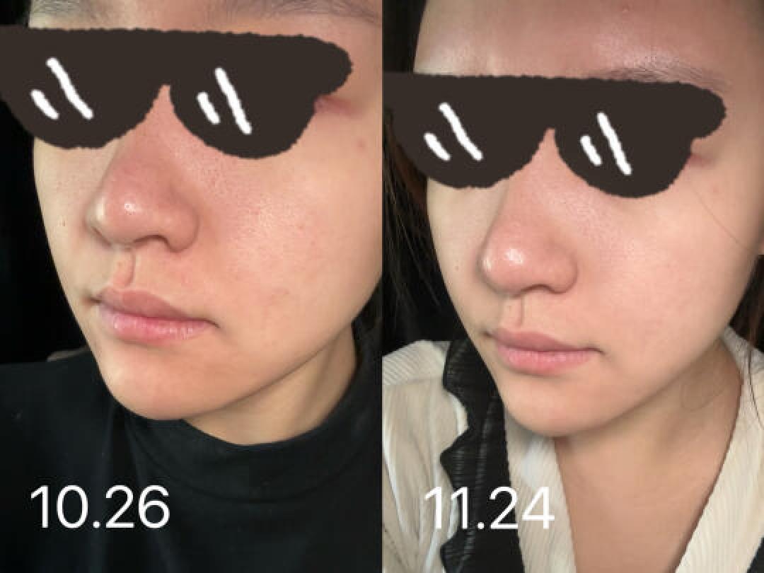 珀莱雅早C晚A组合:熬夜党和抗老护肤的必备选择