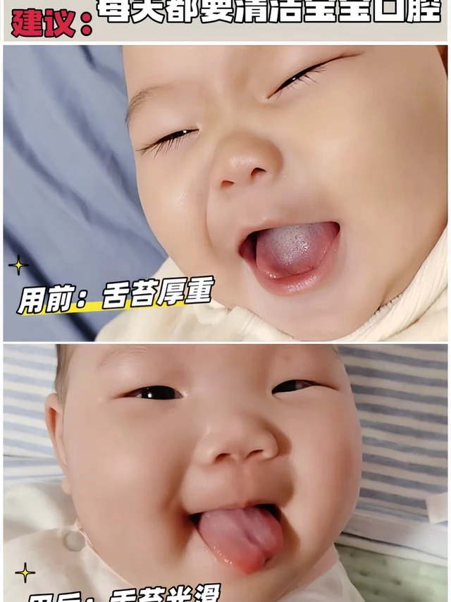 别等娃口腔异味才想起清洁哦！清洁要趁早👶 
新手宝妈们看过来！宝宝的口腔护理可不能马虎，稍不注意，奶瓶龋就会找上门😱 
我家宝宝刚长牙的时候，我还没太在意口腔清洁，结果体检的时候医生提醒，乳牙护理不当