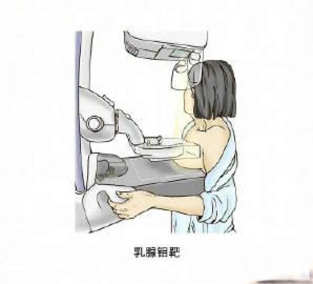 乳腺癌谣言TOP5:这些误区你可能还在信