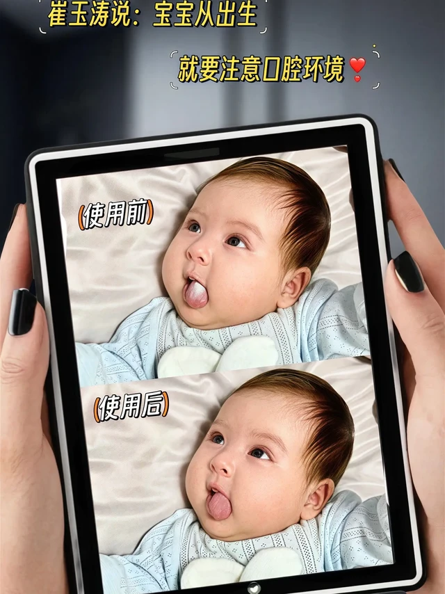 新手爸妈必看！宝宝口腔清洁一步到位👶。当妈之后才知道，宝宝的口腔清洁从出生就得重视！稍不注意，奶渍残留就容易让小嘴巴有异味，还可能影响牙齿健康。在给宝宝选口腔清洁用品这条路上，我也算踩过不少雷，直到发