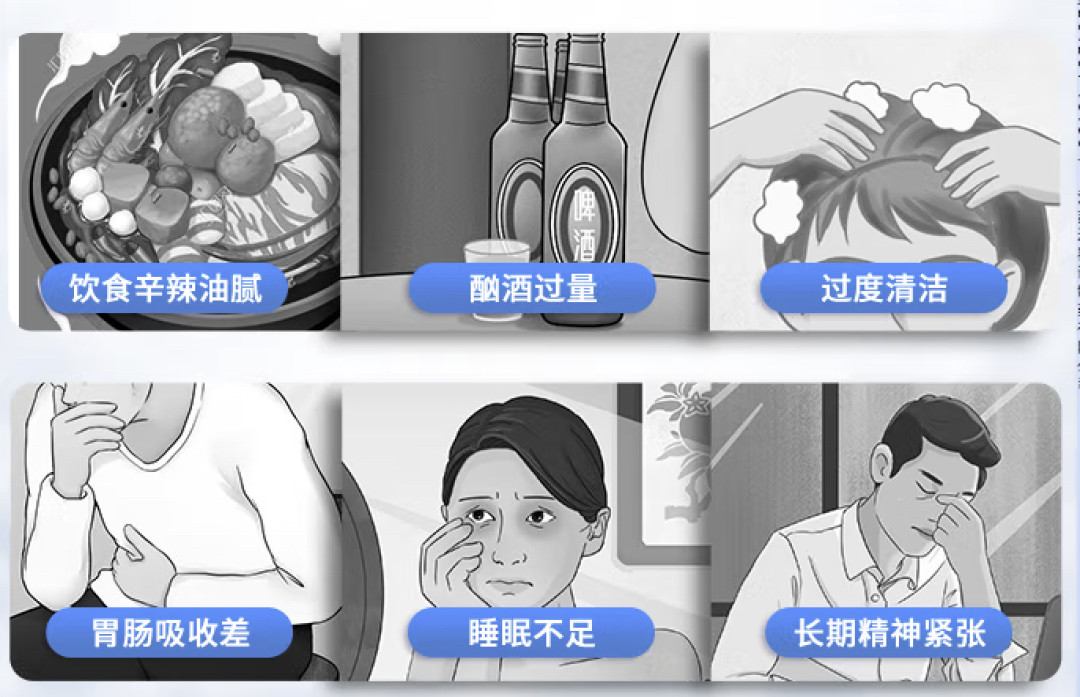 摆脱脂溢性皮炎,拯救“油头屑”!