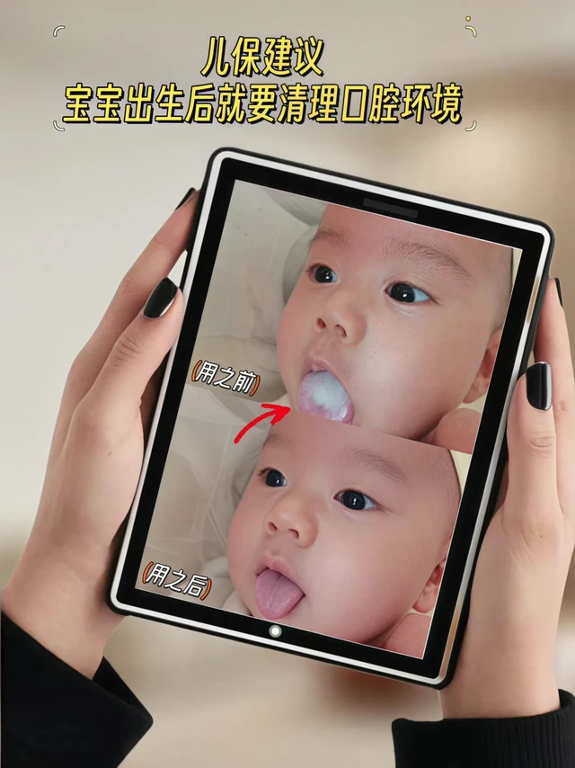 养娃不走弯路！口腔清洁从娃娃抓起👶。当妈以后，才知道宝宝的口腔护理有多重要！新生儿的口腔黏膜娇嫩，稍不注意就容易有奶渍残留、滋生细菌🦠 要是等长出牙再重视，可能就晚啦！
 
科巢这款口腔清洁器真的相见