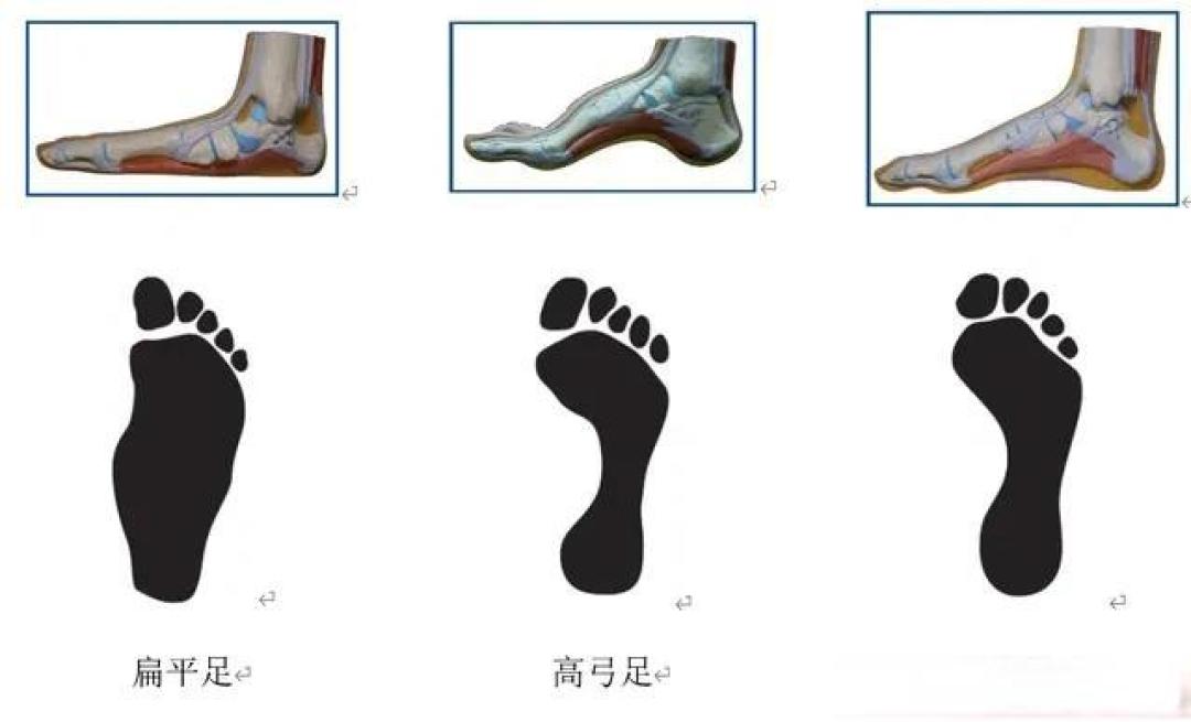 跑步鞋选购避坑指南:从脚型到场景的三大黄金法则