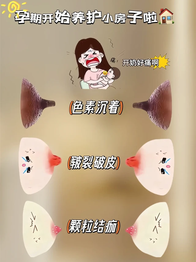 孕妈哺乳期妈妈必看！袋鼠妈妈羊脂膏，真的神！ 
姐妹们，怀孕生子的过程里，各种肌肤小状况真的超烦。特别是孕期和哺乳期，娇嫩部位的护理一不小心就容易出问题。但还好我发现了袋鼠妈妈孕妇羊脂膏 ，轻松解决了