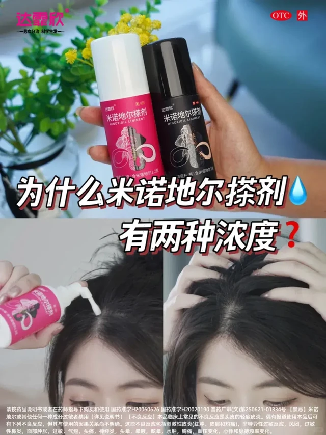 达霏欣米诺地尔搽剂💧两种浓度怎么选❓