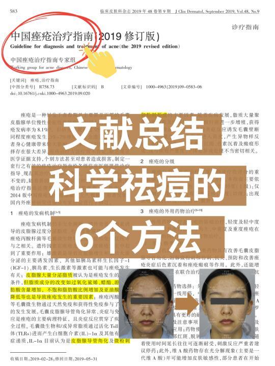 痘肌必看|文献祛痘的6大指南🎯