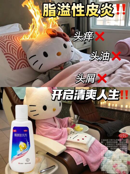 脂溢性皮炎哪有不疯的！！！