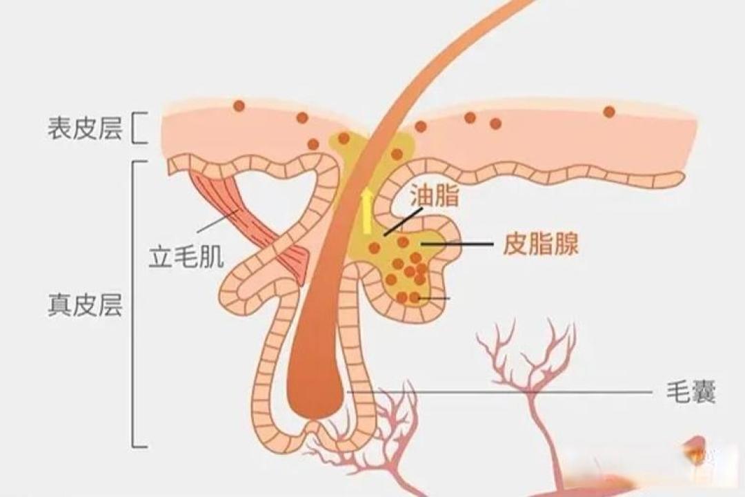T区油痘肌终结指南：科学控油+内调外养告别恶性循环