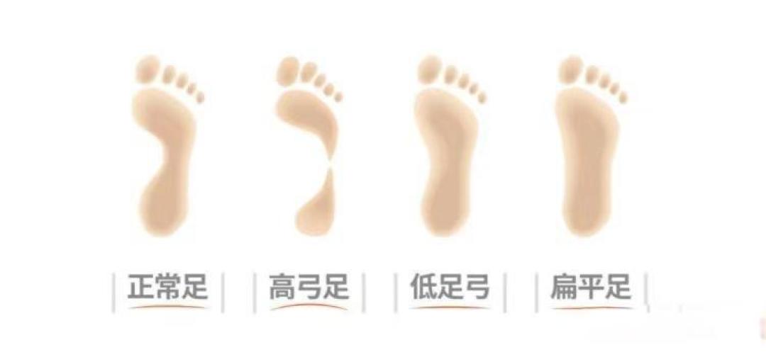 足弓密码+避坑指南!选跑鞋必看的3大黄金法则