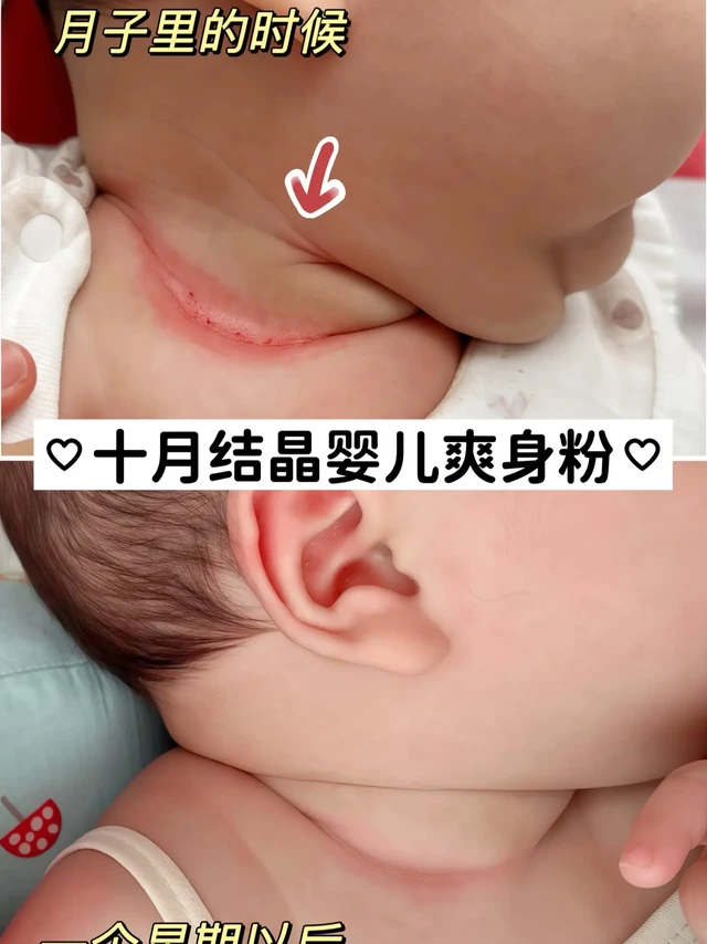 胖宝宝救星!宝妈闭眼入👶。家有胖宝的看过来!新生儿时期宝宝肉肉多,脖子、PP、腋下老是红红的,可把我愁坏了。幸好让我挖到了十月结晶家的爽身粉,简直是胖宝宝的救星!它不添加滑石粉,给新生儿用也超安心。哪