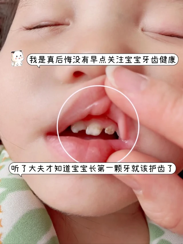 直到宝宝牙齿出了问题我才知道要护理口腔。去了医院检查才知道，宝宝长第一颗乳牙的时候就要护理口腔了，我总以为宝宝光喝奶应该不用，就这么粗心大意的导致牙齿出现了今天这么严重的问题，孩子虽然小，但是吃夜奶后