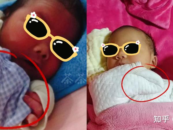 新手妈妈孕晚期要准备待产包了，不知道该买些什么？有没有宝妈愿意分享一下你的经验的？