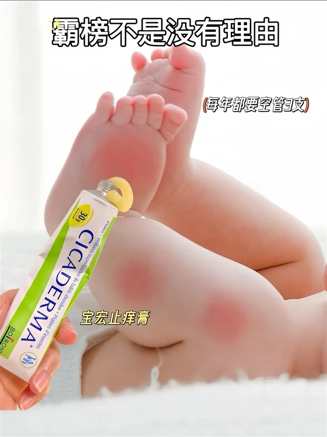 夏日必备指南，轻松应对夏日困扰，守护全家。随着气温升高，各类昆虫活动频繁，皮肤敏感人群尤其需要贴心呵护。BOIRON 宝弘金盏花修护膏采用天然植物萃取技术，为日常防护提供新思路：
•轻盈触感：乳霜质地